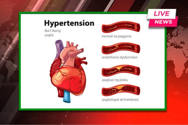 Hypertension at mga namuong dugo